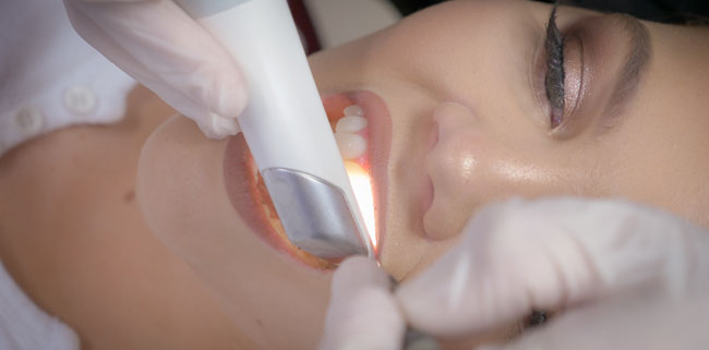 Intra Oral Scanner