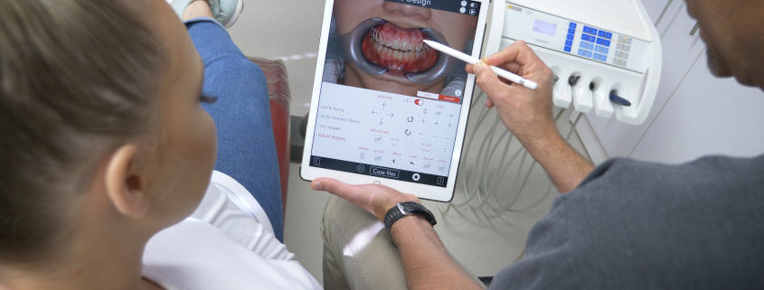What is Digital Smile Design
