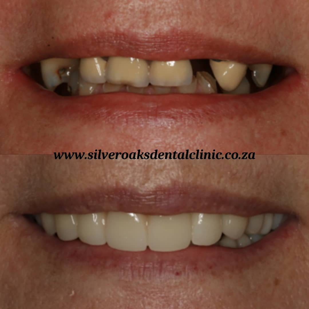 cosmetic dentistry in south africa